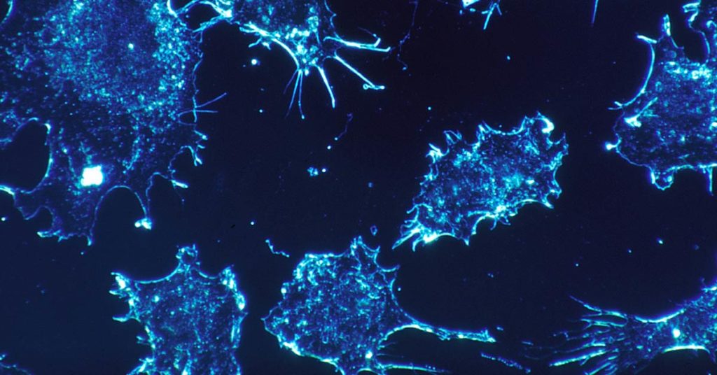 Gli agenti cancerogeni e mutageni possono provocare mutazioni cellulari e causare neoplasie. In foto delle cellule tumorali