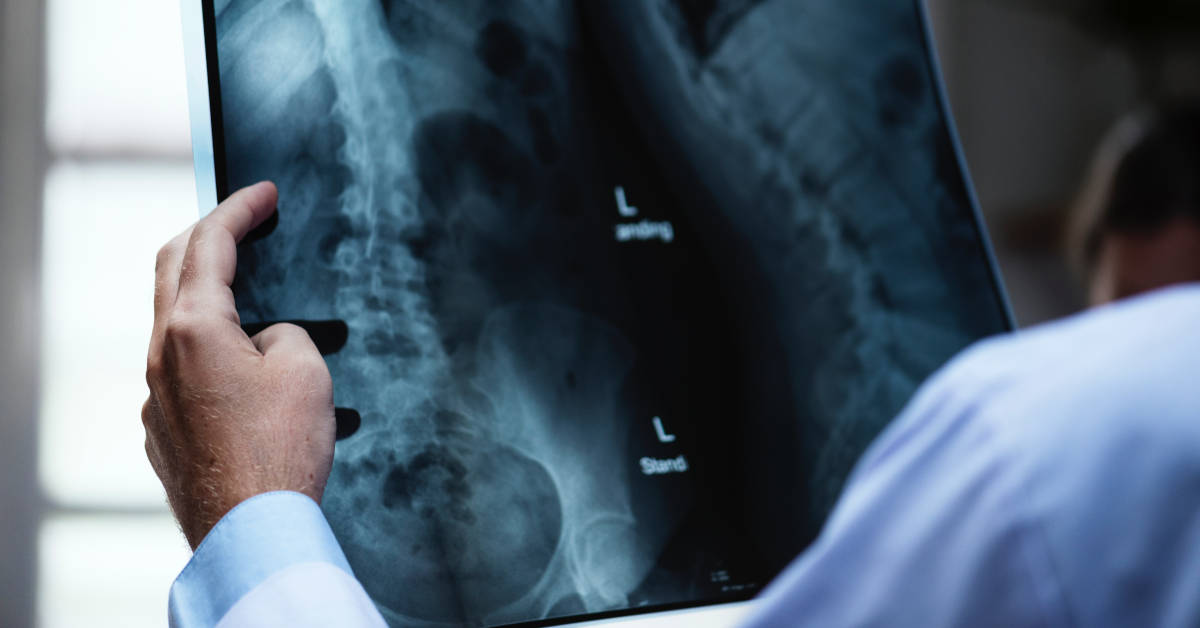 Un medico controlla una lastra. La Regione approva il Protocollo di sorveglianza sanitaria dei lavoratori ex esposti all'amianto