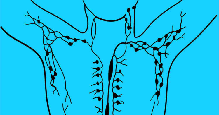 Infografica del sistema linfatico. Il linfoma non-Hodgkin di origine professionale
